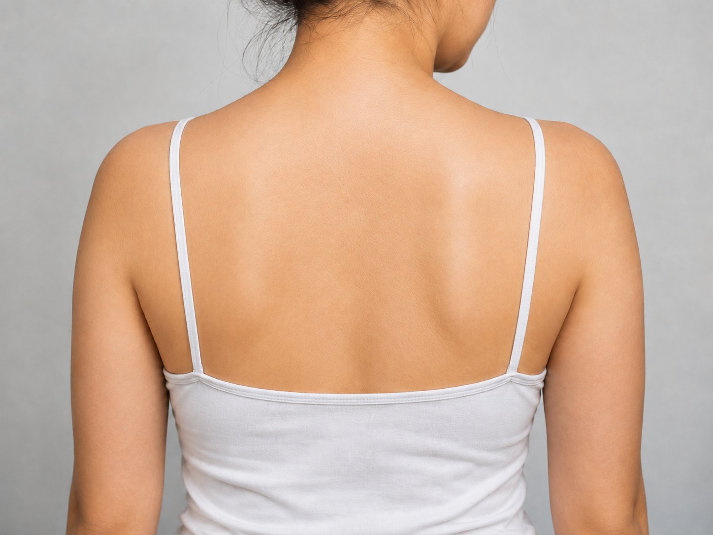 Urticaria rash — before treatment